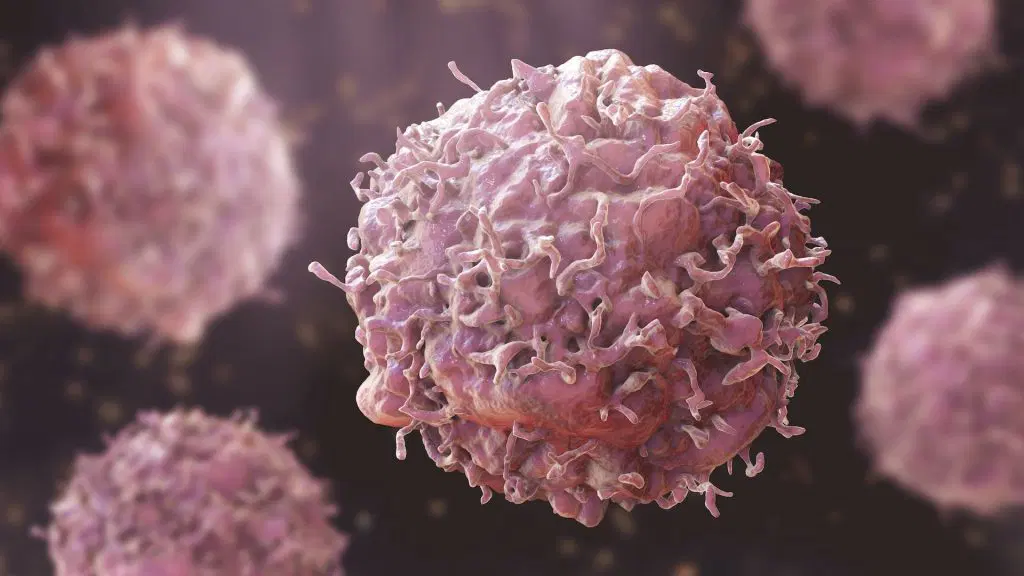 Early cancer diagnosis boosts treatment success — FG