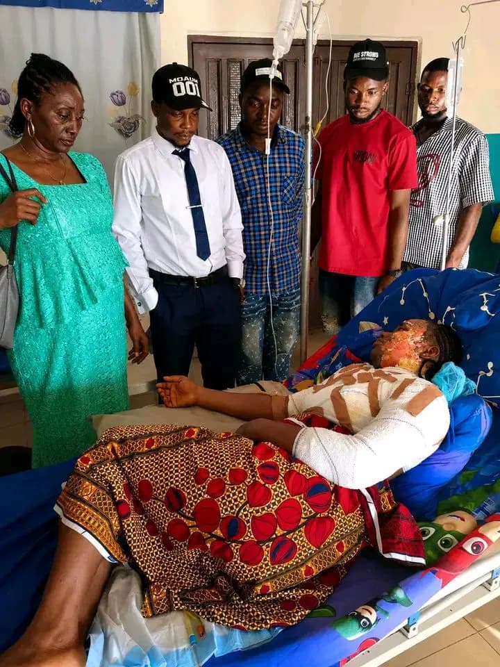 Hot water attack: University student hospitalised with severe burns in Benue