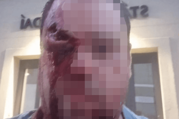 Three hospitalised after brutal street brawl involving machete and acid