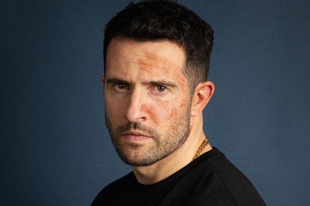 Emmerdale Ross actor's love life from co-star split to engagement that was nearly ruined