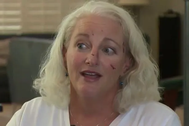 Woman left drenched in blood and needing 38 stitches after being mauled by wild otter