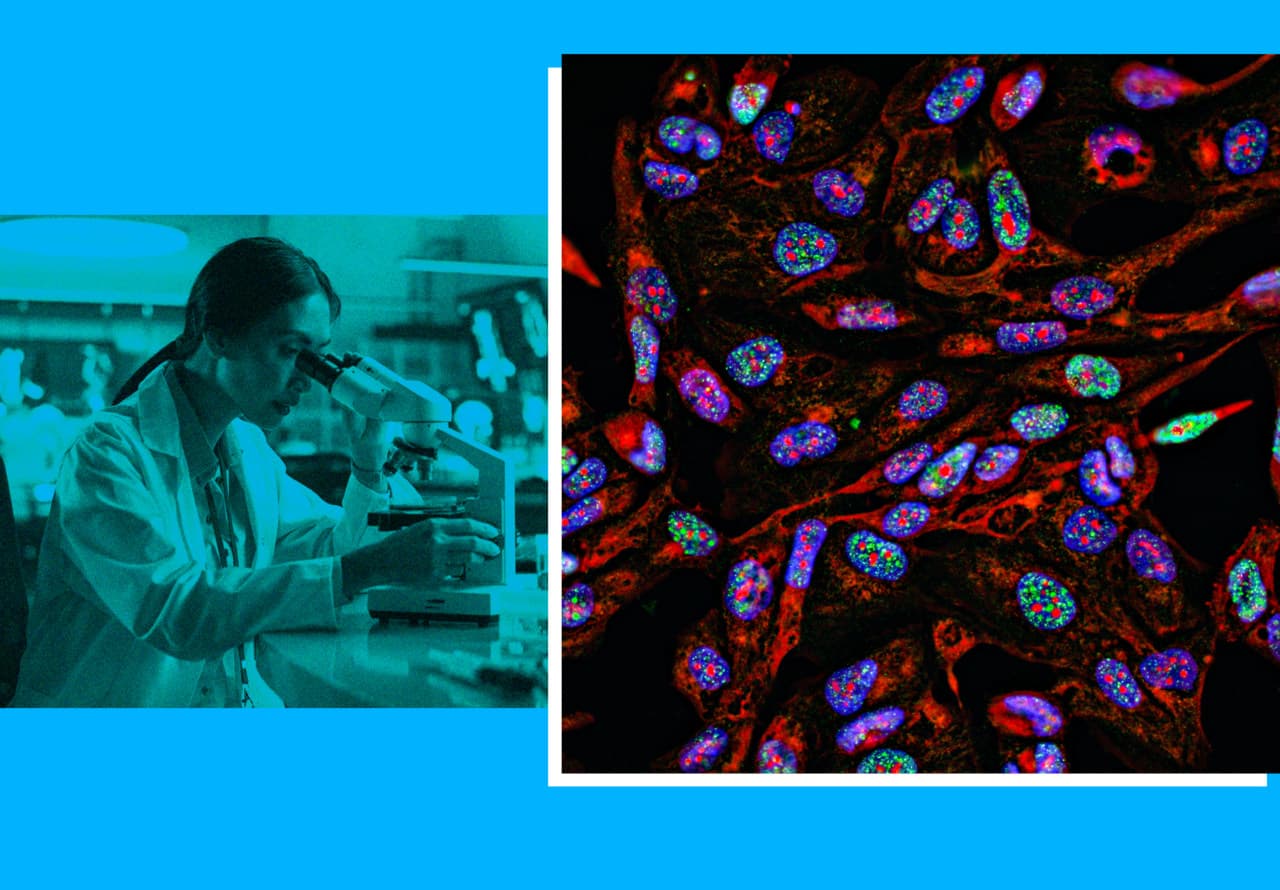 Moderna’s personalized mRNA shot could reshape the fight against skin cancer — but it may also be overhyped