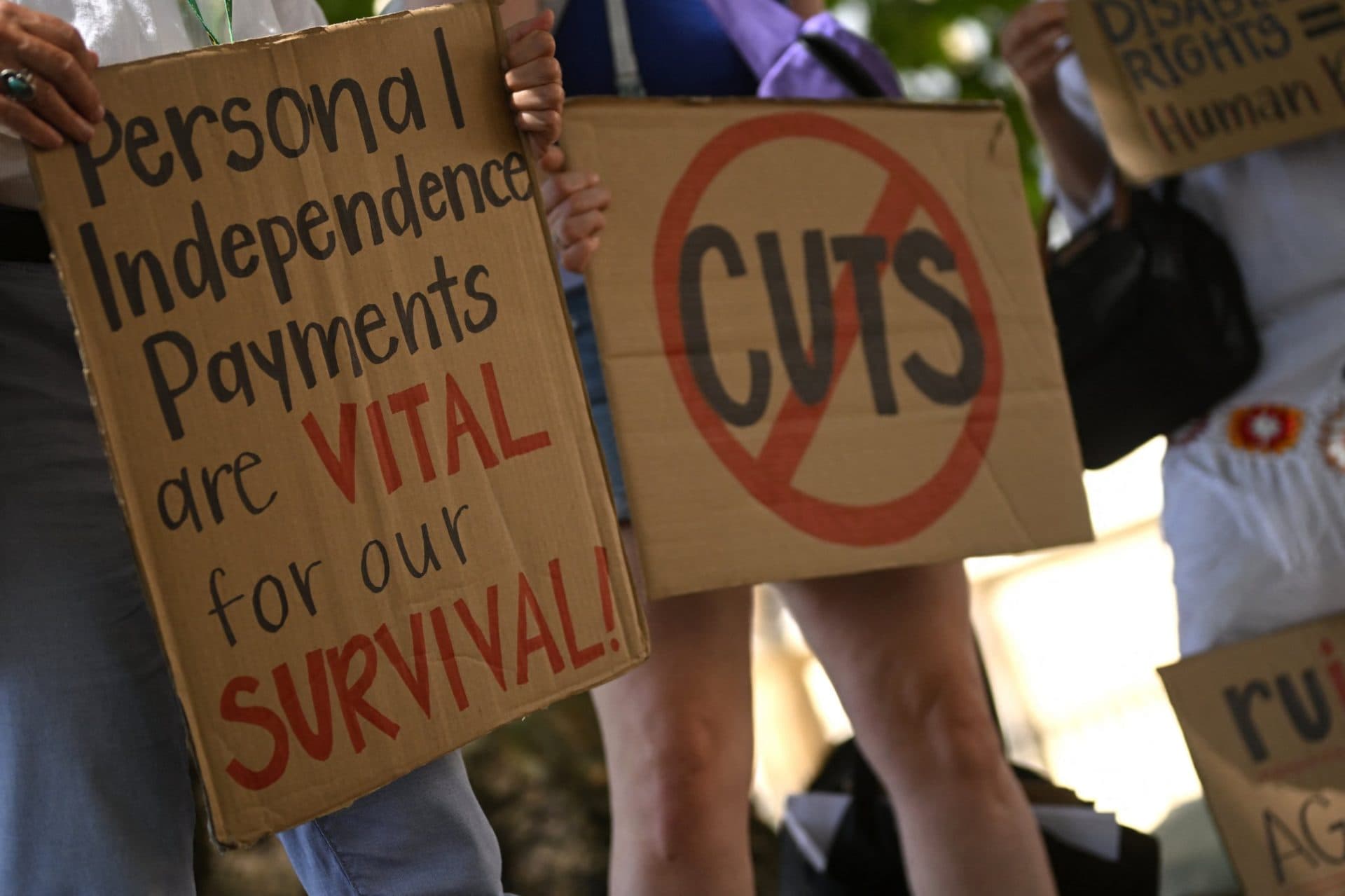 Even I am considered disabled – what qualifies for PIP has to change