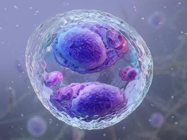 2 deaths reported in cyclosporiasis outbreak, health officials say
