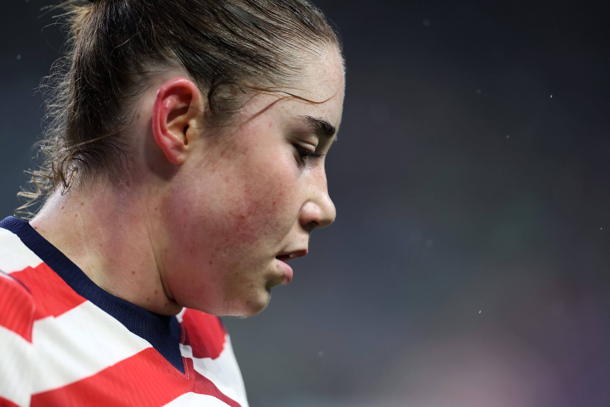 Thorns' Olivia Moultrie to miss remainder of season after suffering ACL injury