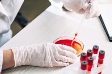Person dies from West Nile virus infection acquired in Netherlands