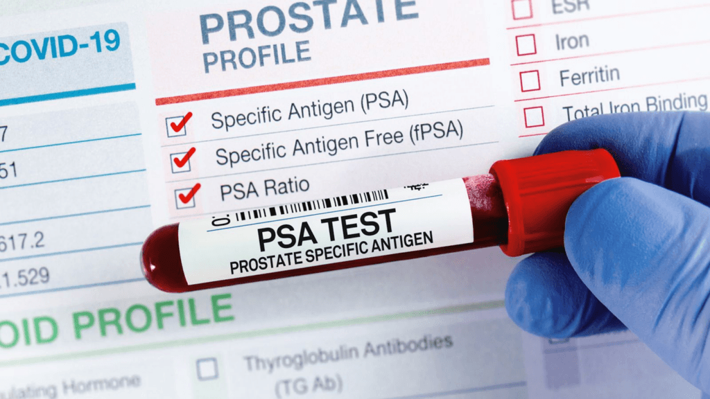One man diagnosed with prostate cancer in the UK ‘every eight minutes’