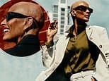 Melanie Sykes looks beautiful in first shoot since shaving her head after revealing alopecia battle