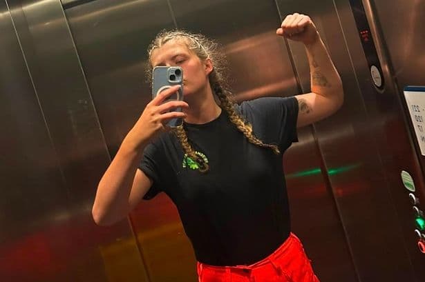 Dad in tears as daughter, 23, suffers 'worst injury doctors have seen' on dream HGV job