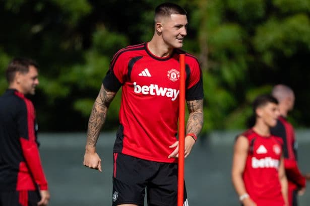Three major Manchester United injury updates ahead of Hull City clash