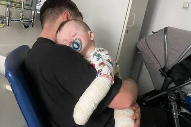 Toddler left with second-degree bleach burns as nursery admits safety breach