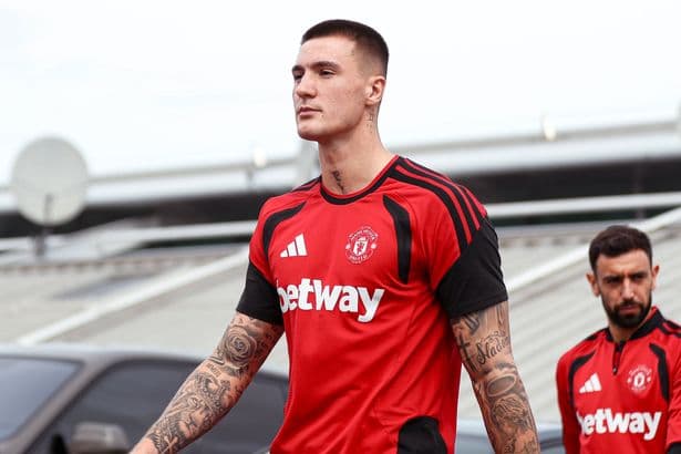Manchester United confirm injury boost ahead of Hull fixture