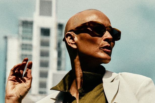 Melanie Sykes stars in first modelling shoot since going public with alopecia battle