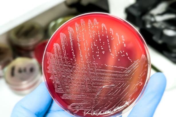 Salmonella case discovered in Wales after UK outbreak leaves one dead and hundreds ill