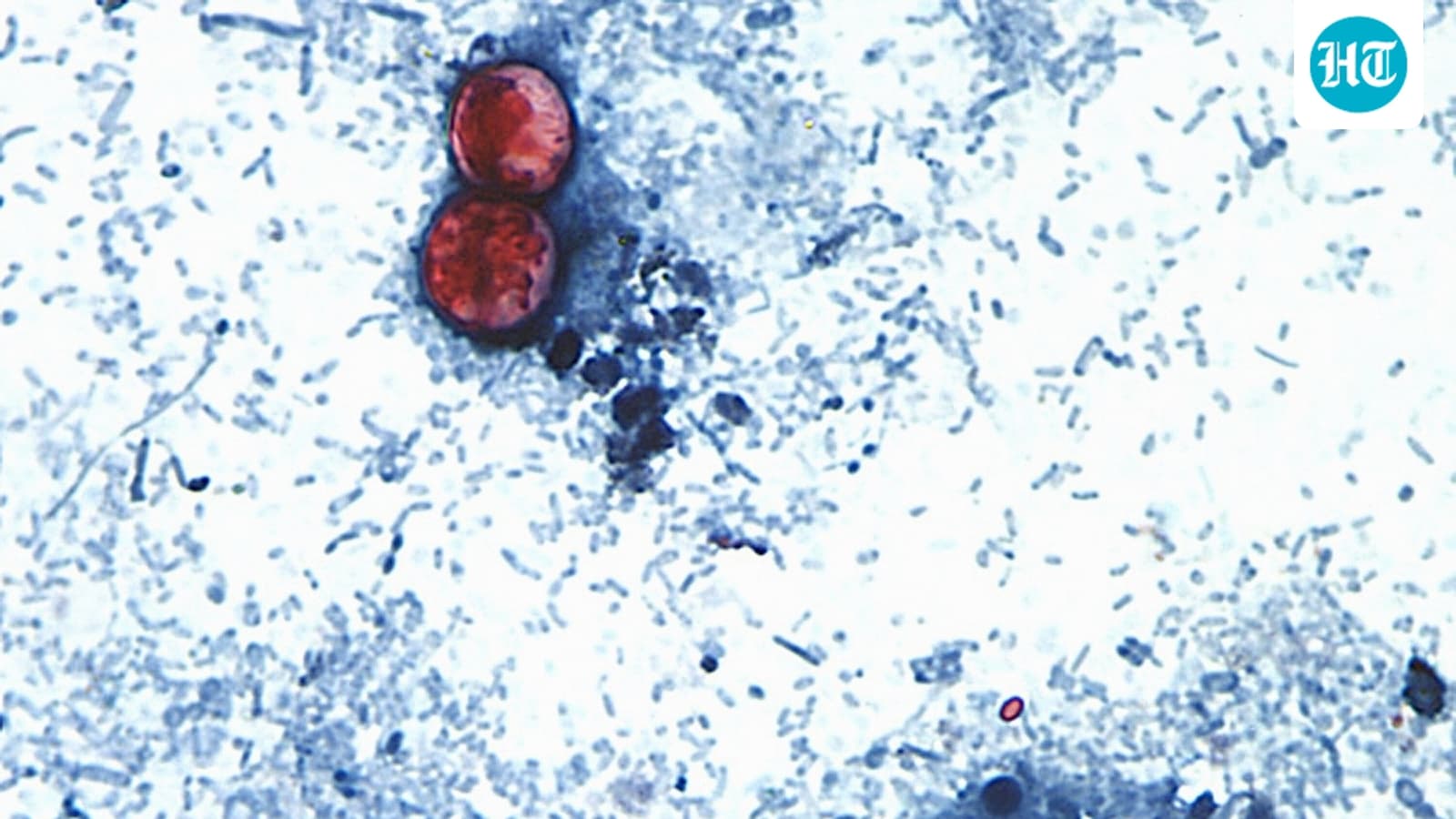Cyclospora outbreak: 2 people die in Michigan; know symptoms, know to stay safe and more